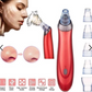 Blackhead instrument pore cleaner to blackhead artifact electric acne machine to blackhead